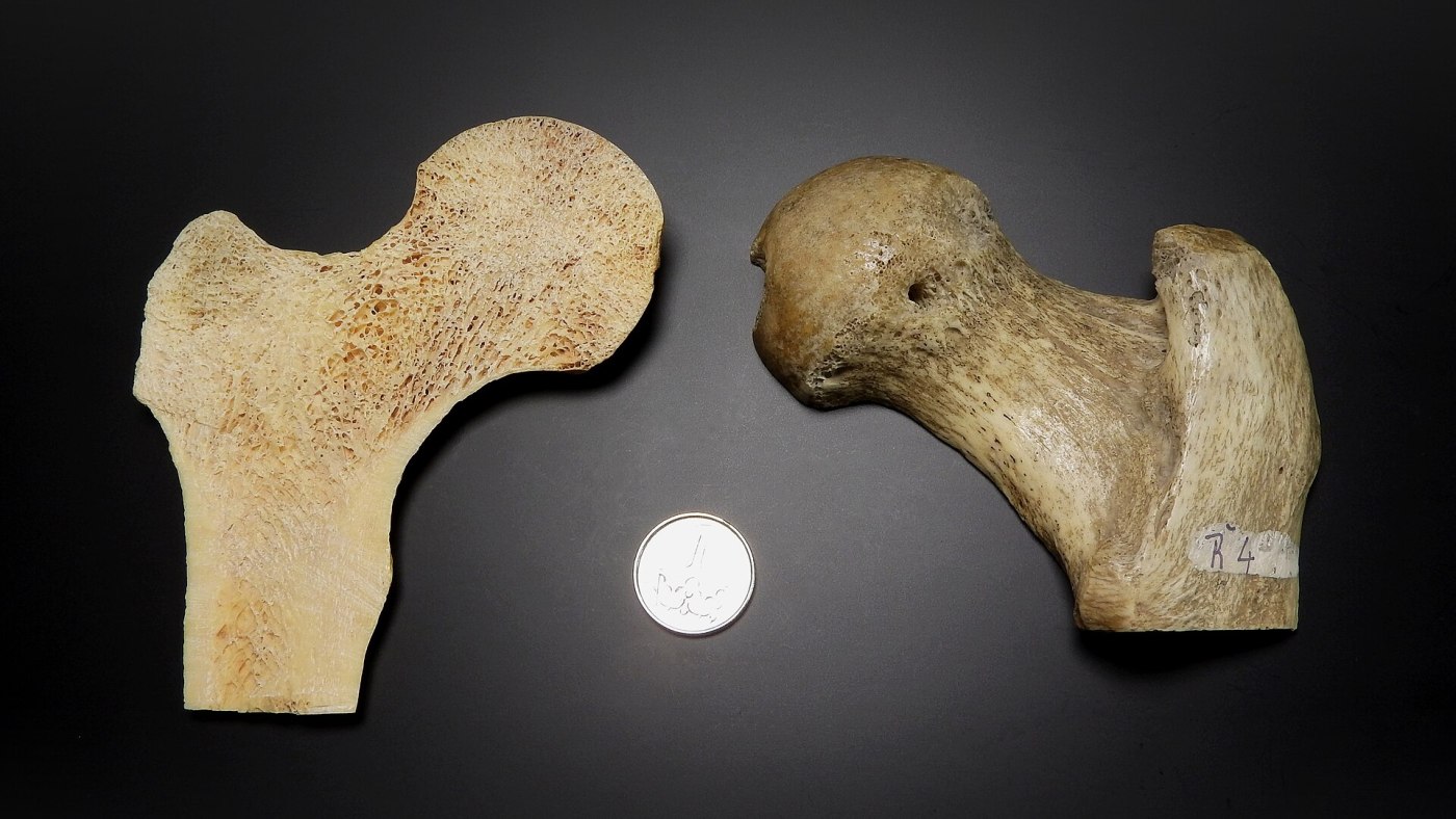 femur bone; left side of image shows the inside of the femur; right side of the image shows the outside of the femur
