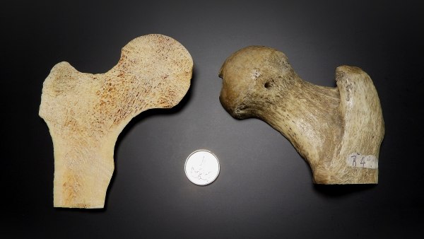 femur bone; left side of image shows the inside of the femur; right side of the image shows the outside of the femur